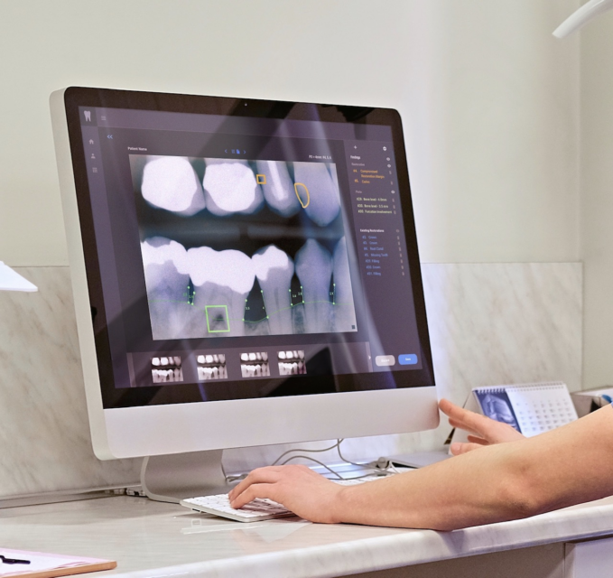 Why I Joined Overjet: The Rising Era of AI in Dental Care Delivery
