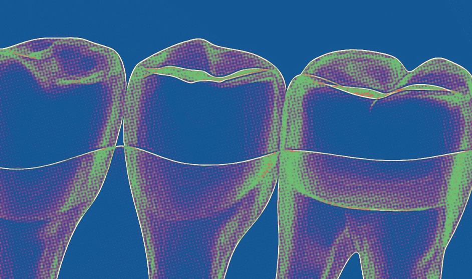 4 Compelling Results of Building a Successful DSO Using Dental AI