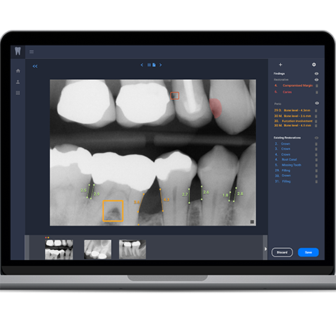 Dental AI is showing pearl white teeth image