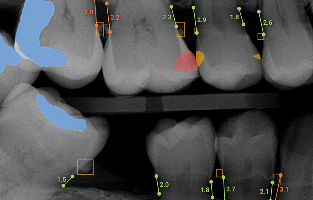 Dental AI Platform for DSOs, dental groups, dental practices after image
