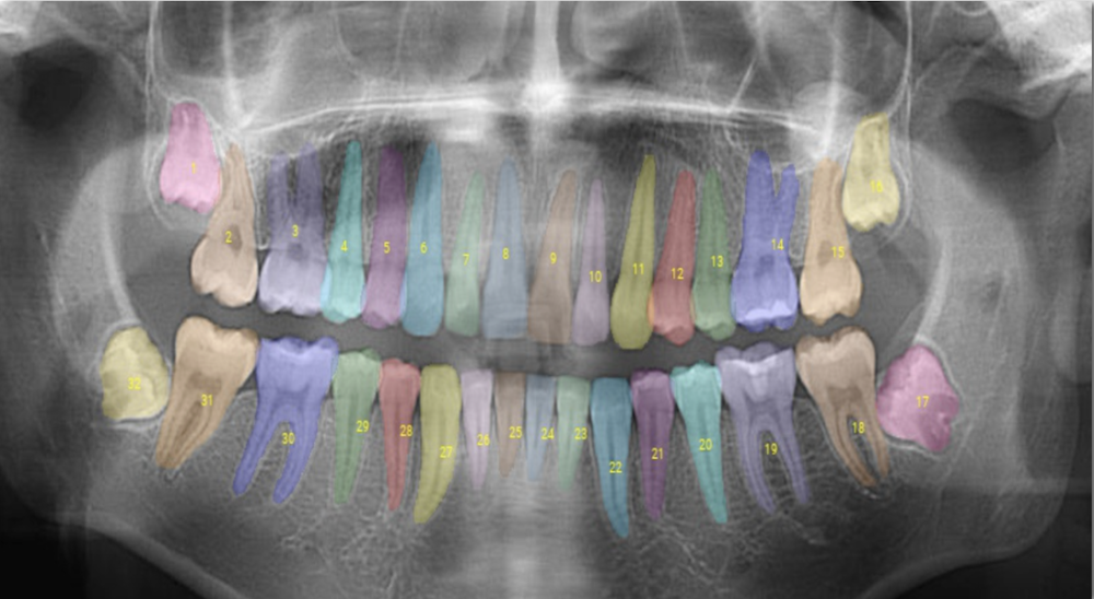MIT News: Taking the guesswork out of dental care with artificial intelligence