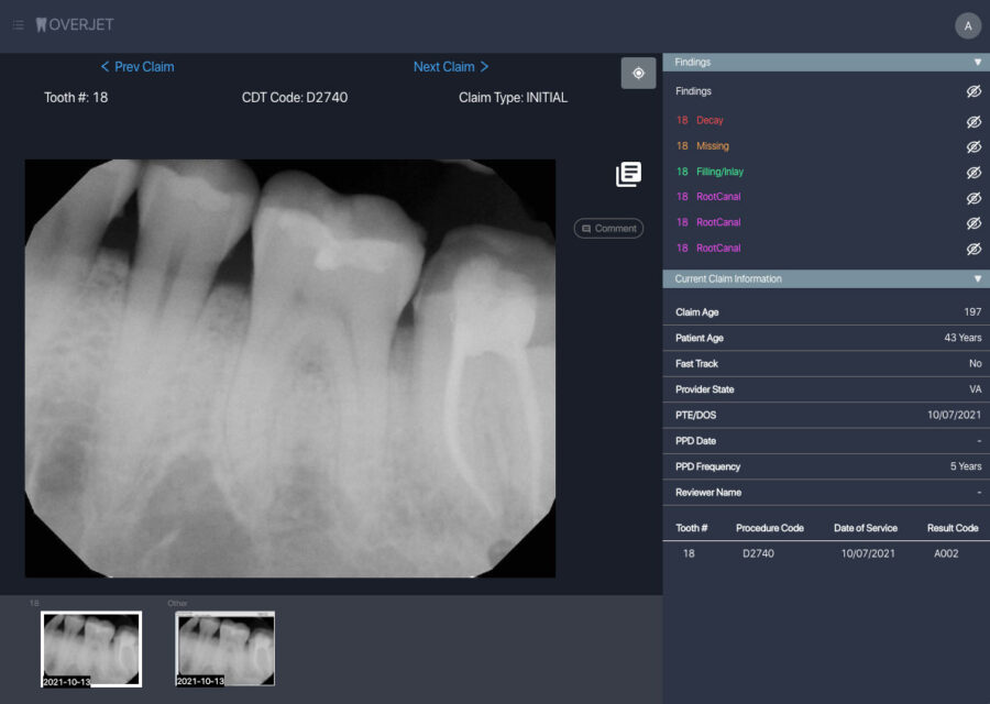 Utilization Management and Review (Dental AI) before image