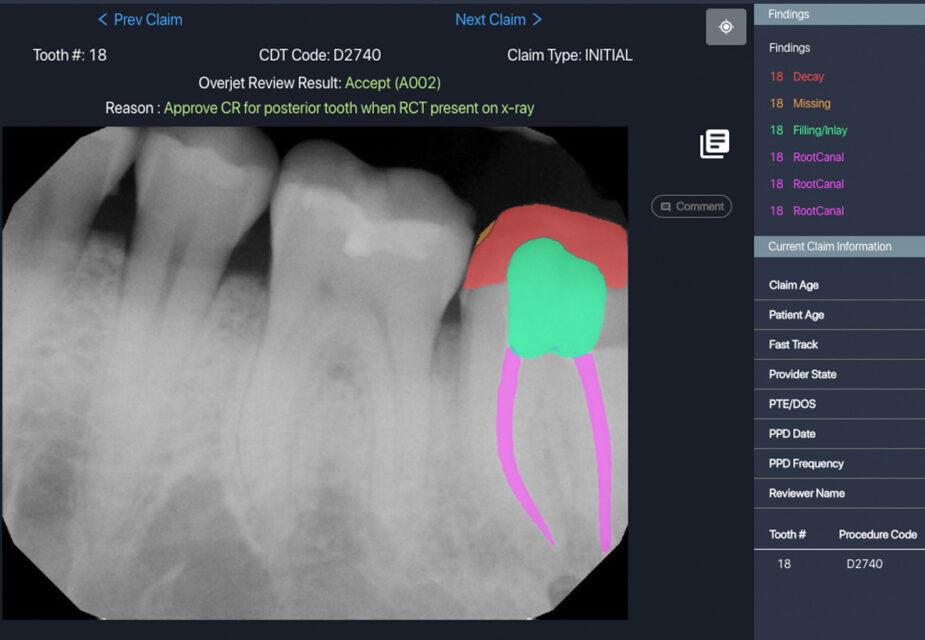 Overjet dental AI platform for insurance companies image