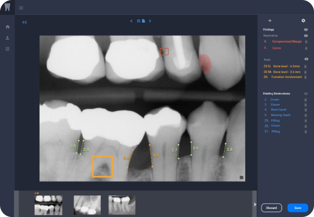 Dental Assist Overjet AI platform for DSOs image