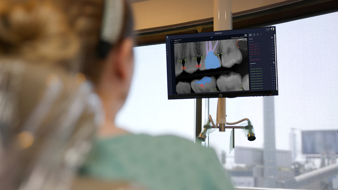 The Case for the Future of Dental Diagnosis Using AI