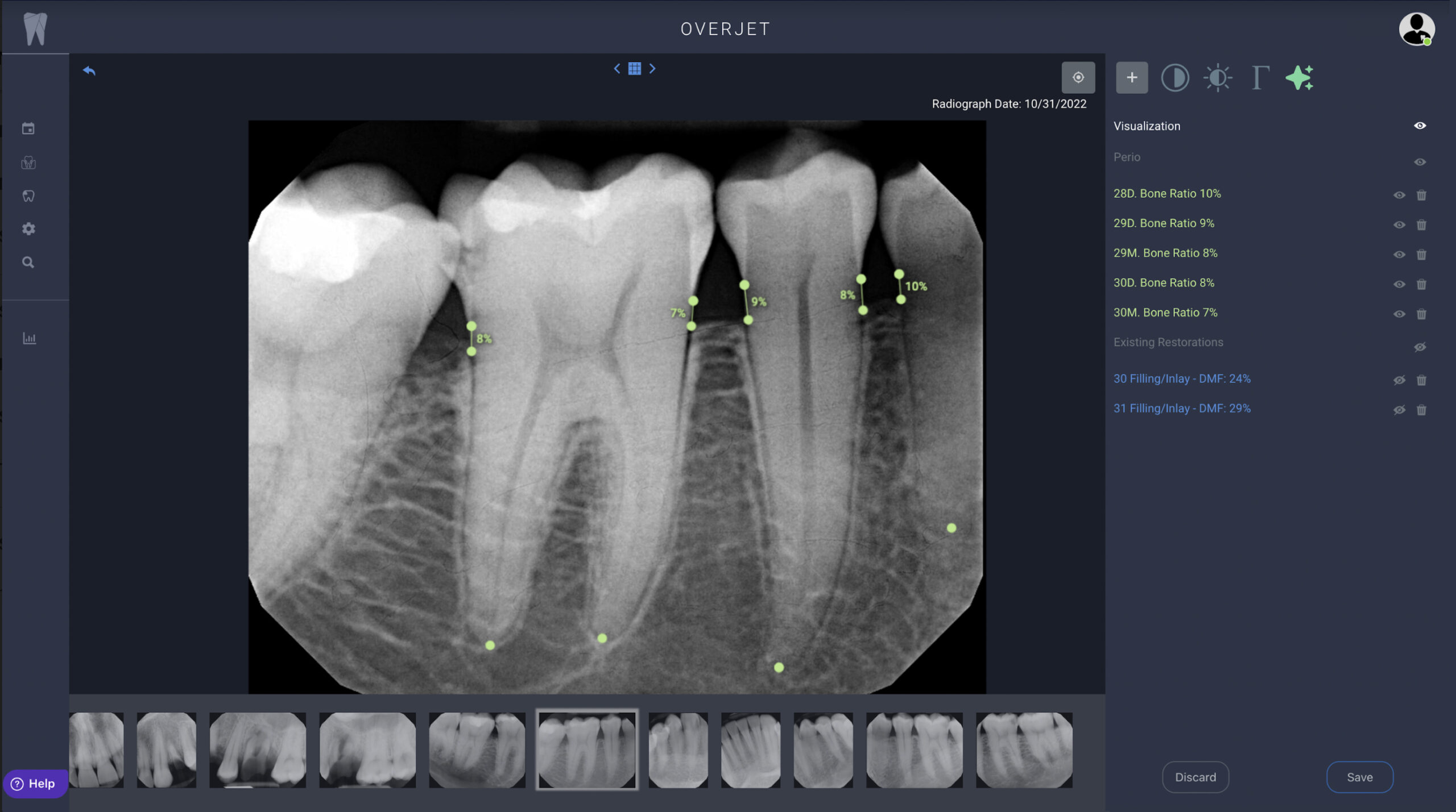 Radiograph with Image Auto Enhancement