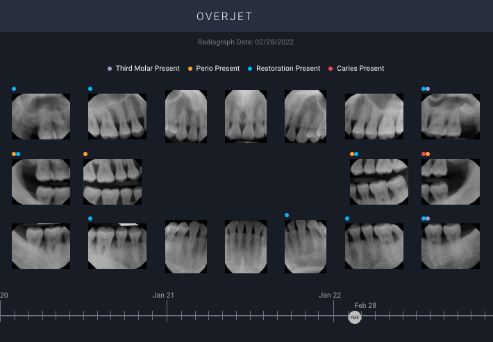 dental xr-ay series