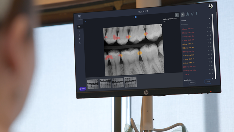 Patient views X-ray with Overjet's AI annotations.