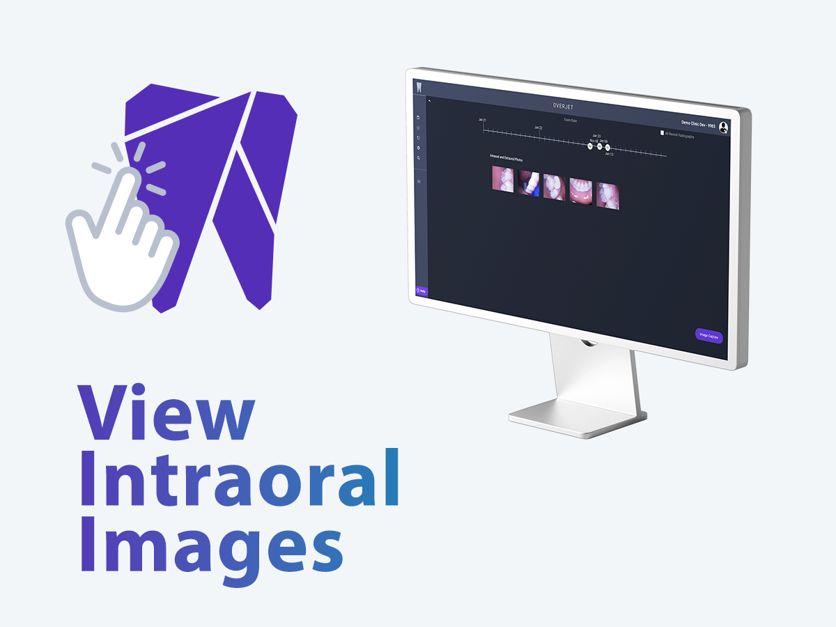 View Intraoral Camera Images